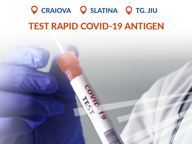Testează-te RAPID pentru a afla dacă ești infectat sau nu cu SARS-CoV-2!